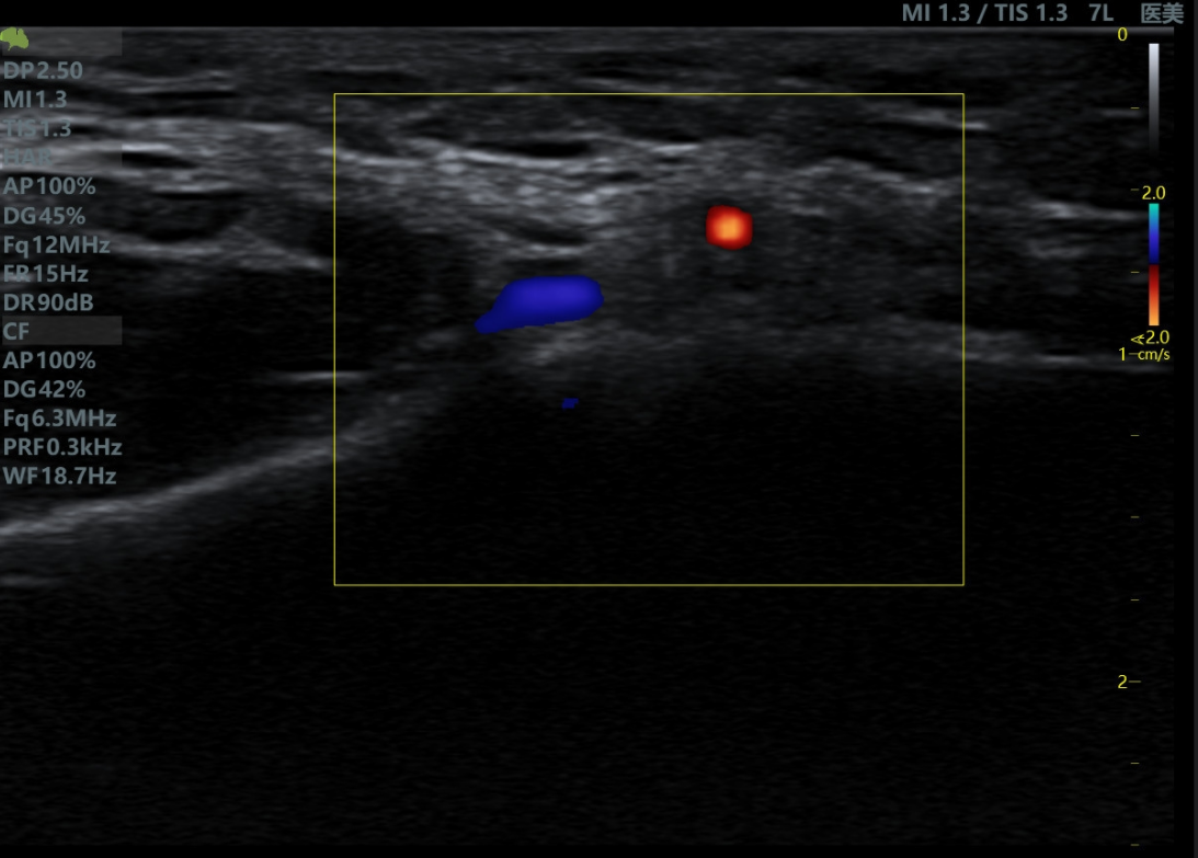 Face Artery & Vein