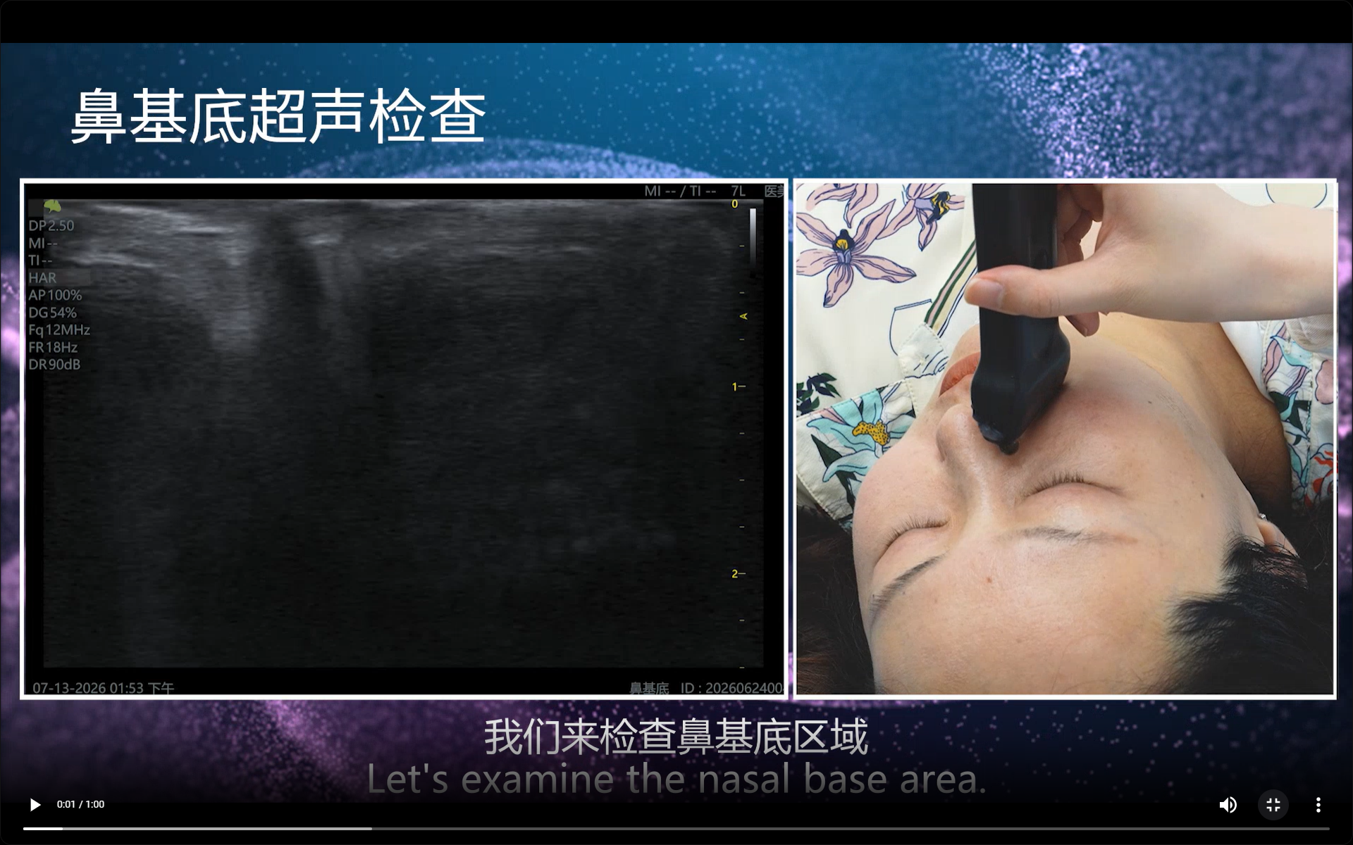 Nasal Base