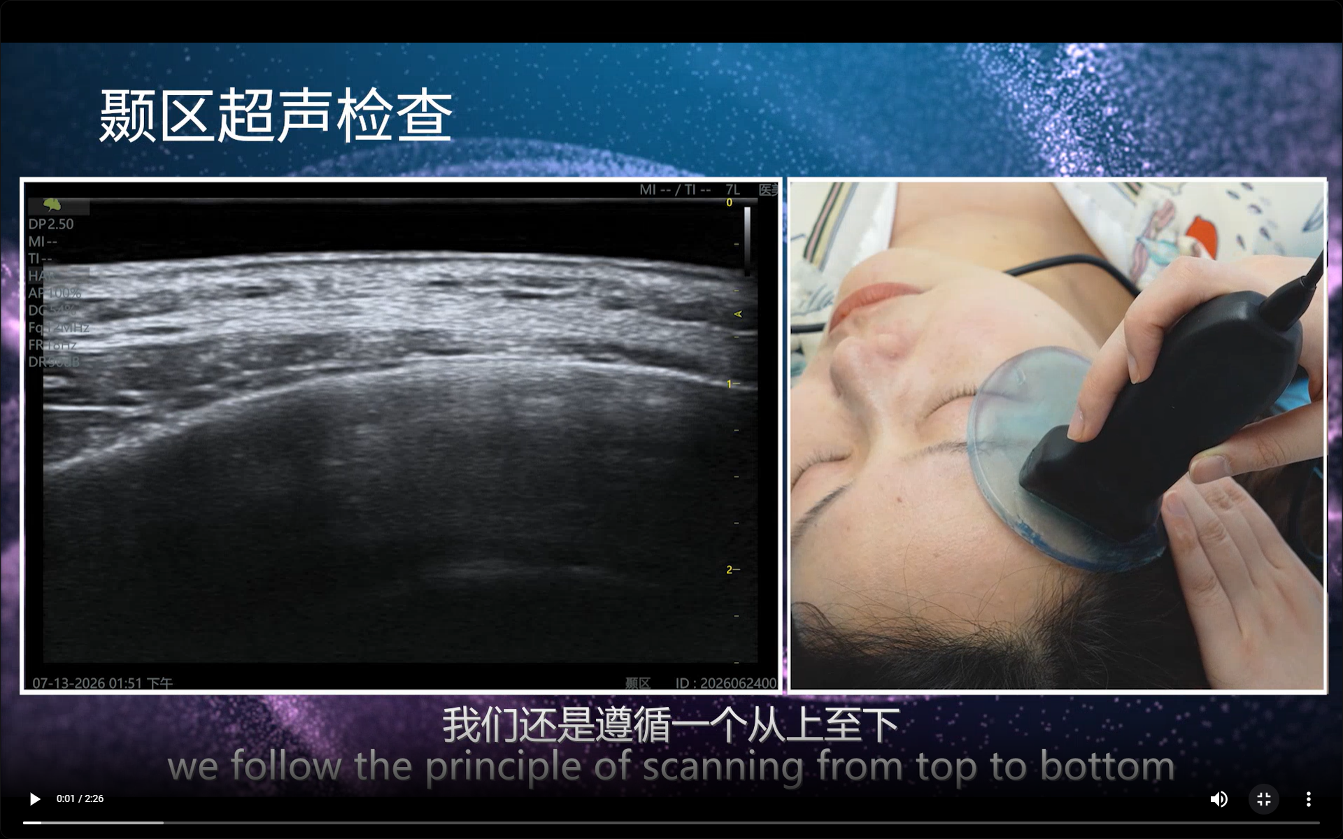 Temporal Region