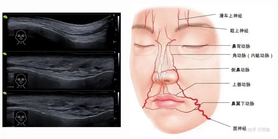 Portable ultrasound as the physician's third eye