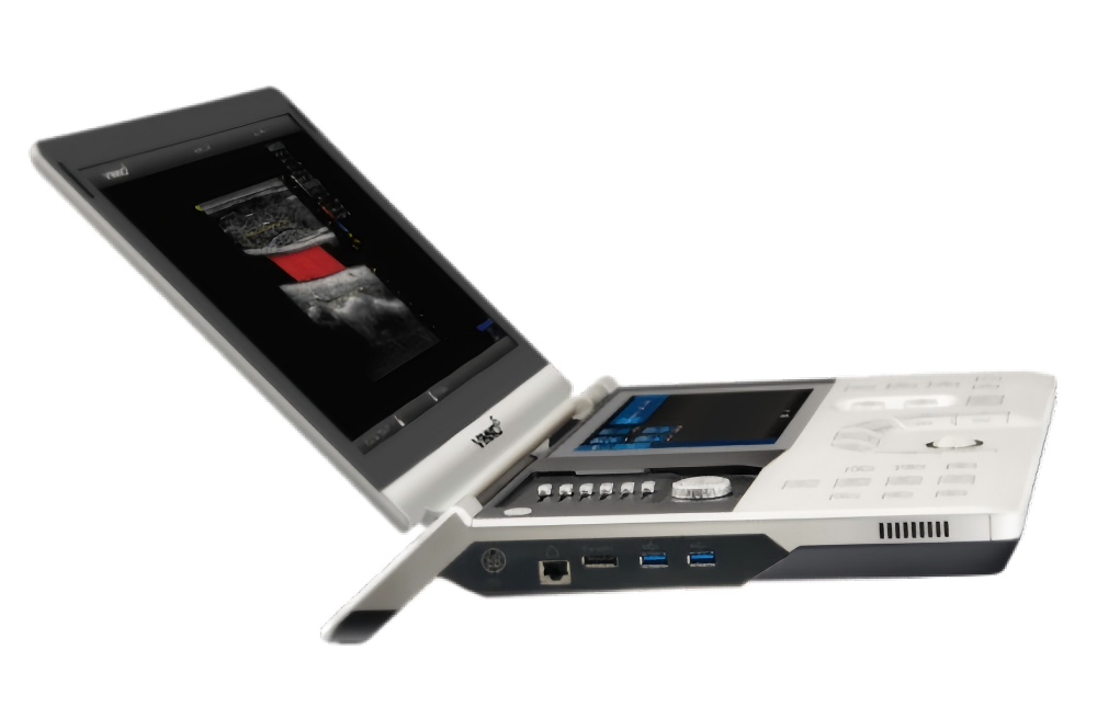 Portable Ultrasound
