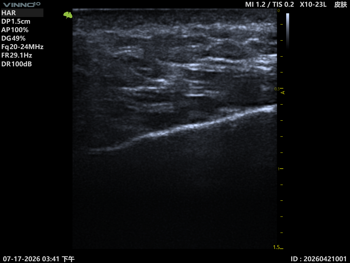 Facial Ultrasound Imaging 2